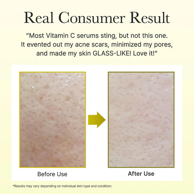 Arencia Vitamin c booster short serum (30ml)